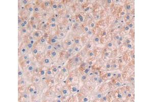 Immunohistochemistry (IHC) image for anti-Solute Carrier Family 25 (Carnitine/acylcarnitine Translocase), Member 20 (SLC25A20) (AA 1-301) antibody (ABIN5013296)
