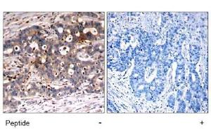 Image no. 1 for anti-SHC (Src Homology 2 Domain Containing) Transforming Protein 1 (SHC1) (Tyr427) antibody (ABIN197590)