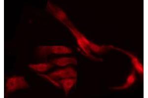 Immunofluorescence (fixed cells) (IF/ICC) image for anti-Tumor Protein P53 (TP53) (pSer9) antibody (ABIN6255556)