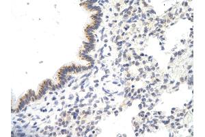 Immunohistochemistry (IHC) image for anti-Voltage-Dependent Anion Channel 3 (VDAC3) (N-Term) antibody (ABIN2776182)