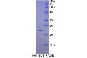 SDS-PAGE (SDS) image for Cytochrome P450, Family 19, Subfamily A, Polypeptide 1 (CYP19A1) (AA 196-373) protein (His tag) (ABIN1877887)