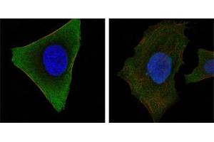 Confocal immunofluorescence analysis of Hela (left) and HepG2 (right) cells using JAK3 mouse mAb (green). (JAK3 抗体)