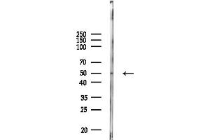 anti-Interleukin 13 Receptor, alpha 2 (IL13RA2) (C-Term) antibody