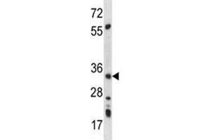 AMPK beta 2 antibody western blot analysis in mouse kidney tissue lysate (PRKAB2 抗体  (AA 3-33))