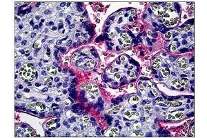 Human Placenta: Formalin-Fixed, Paraffin-Embedded (FFPE) (CD51 抗体  (C-Term))