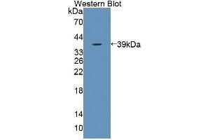 Western blot analysis of the recombinant protein. (KEL 抗体  (AA 49-358))