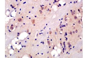 Formalin-fixed and paraffin embedded rat brain labeled with Rabbit Anti-5HT2A Receptor/SR-2A Polyclonal Antibody, Unconjugated (ABIN1386671) at 1:200 followed by conjugation to the secondary antibody and DAB staining (HTR2A 抗体  (AA 51-150))