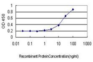 Detection limit for recombinant GST tagged SOX30 is approximately 1ng/ml as a capture antibody. (SOX30 抗体  (AA 644-753))