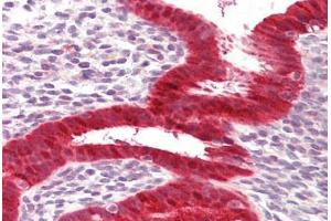 Anti-RIG-1 / RIG-I antibody IHC staining of human uterus. (DDX58 抗体  (AA 200-250))