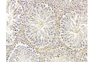 ABIN7095940 and ABIN7100002 at 1/100 staining rat testis tissue by IHC-P.