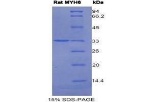 SDS-PAGE (SDS) image for Myosin Heavy Chain 6, Cardiac Muscle, alpha (MYH6) (AA 419-666) protein (His tag) (ABIN1981137)