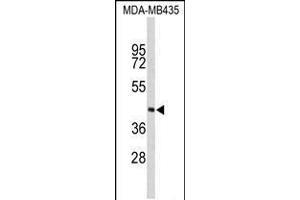 Western blot analysis of PHYH Antibody in MDA-MB435 cell line lysates (35ug/lane) (PHYH 抗体  (N-Term))