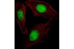 Immunofluorescence (IF) image for anti-Sterol Regulatory Element Binding Transcription Factor 2 (SREBF2) antibody (ABIN2995769) (SREBF2 抗体)