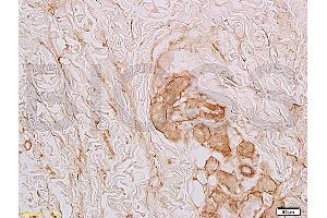 Immunohistochemistry (IHC) image for anti-Collagen, Type VI, alpha 1 (COL6A1) (AA 951-1028) antibody (ABIN670011)