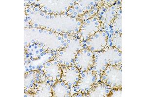 Immunohistochemistry of paraffin-embedded mouse kidney using Tau antibody (ABIN3021441, ABIN3021442, ABIN3021443 and ABIN6215045) at dilution of 1:100 (40x lens). (MAPT 抗体  (AA 1-100))
