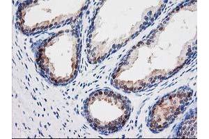 Immunohistochemical staining of paraffin-embedded Human prostate tissue using anti-SEC14L2 mouse monoclonal antibody. (SEC14L2 抗体)