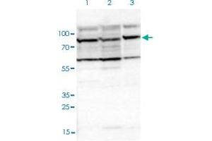 Western blot analysis of Lane 1: Human cell line RT-4; Lane 2: Human cell line U-251MG sp; Lane 3: Human plasma (IgG/HSA depleted) with EIF4ENIF1 polyclonal antibody  at 1:100-1:250 dilution. (EIF4ENIF1 抗体)