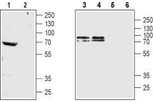 Western blot analysis of rat brain membrane (lanes 1 and 2), mouse brain membrane (lane 3 and 5) and SH-SY5Y cell lysate (lanes 4 and 6): - 1,3,4. (CHRM4 抗体  (3rd Intracellular Loop))