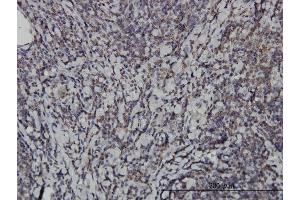 Immunostaining (ISt) image for anti-Inhibitor of kappa Light Polypeptide Gene Enhancer in B-Cells, Kinase epsilon (IKBKE) (AA 541-640) antibody (ABIN523135)