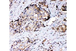 IHC analysis of RPSA using anti-RPSA antibody (ABIN4886715). (RPSA/Laminin Receptor 抗体  (AA 2-138))