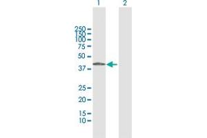 Western Blotting (WB) image for anti-Alcohol Dehydrogenase 7 (Class IV), mu Or sigma Polypeptide (ADH7) (AA 1-386) antibody (ABIN513142)