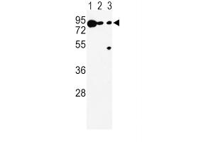 Western Blotting (WB) image for anti-Dopachrome Tautomerase (DCT) antibody (ABIN5024316) (DCT 抗体)