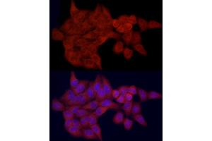 Immunofluorescence analysis of HeLa cells using SLC27 Rabbit pAb (2847) at dilution of 1:100 (40x lens). (SLC27A1 抗体  (AA 347-646))