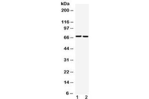 Western blot testing of 1) rat liver and 2) human A549 cell lysate with GAA antibody at 0. (GAA 抗体  (AA 494-527))