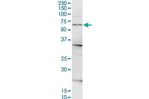 CSGALNACT2 MaxPab rabbit polyclonal antibody. (CSGALNACT2 抗体  (AA 1-542))
