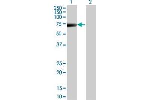 Western Blot analysis of KRT5 expression in transfected 293T cell line by KRT5 monoclonal antibody (M08), clone 1A12. (Cytokeratin 5 抗体  (AA 1-590))