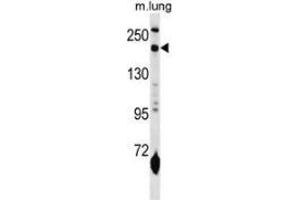 Western blot analysis in mouse lung tissue lysates (35ug/lane) using CD206 / MRC1 Antibody (N-term).