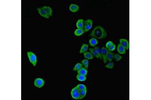 Immunofluorescent analysis of PC-3 cells using ABIN7169234 at dilution of 1:100 and Alexa Fluor 488-congugated AffiniPure Goat Anti-Rabbit IgG(H+L) (WNK4 抗体  (AA 828-1106))