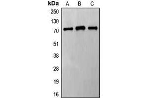 Western blot analysis of Frizzled 8 expression in HeLa (A), Jurkat (B), MCF7 (C) whole cell lysates. (FZD8 抗体  (C-Term))