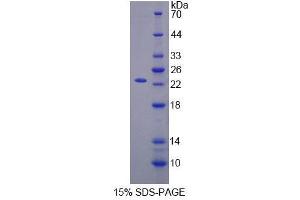 SDS-PAGE analysis of Human SCEL Protein. (SCEL 蛋白)