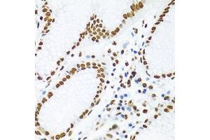 Immunohistochemistry (Paraffin-embedded Sections) (IHC (p)) image for anti-KH Domain Containing, RNA Binding, Signal Transduction Associated 1 (KHDRBS1) (C-Term) antibody (ABIN6142829)