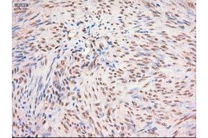 Image no. 1 for anti-Myc Proto-Oncogene protein (MYC) antibody (ABIN1497013) (c-MYC 抗体)