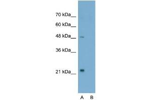 Host:  Rabbit  Target Name:  TSHR  Sample Type:  Jurkat  Lane A:  Primary Antibody  Lane B:  Primary Antibody + Blocking Peptide  Primary Antibody Concentration:  2. (TSH receptor 抗体  (N-Term))