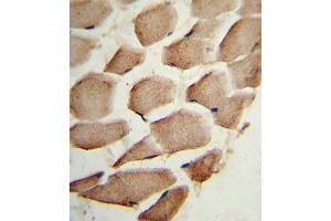 Immunohistochemistry (IHC) image for anti-Actin Related Protein 2/3 Complex, Subunit 1A, 41kDa (ARPC1A) antibody (ABIN3002659)