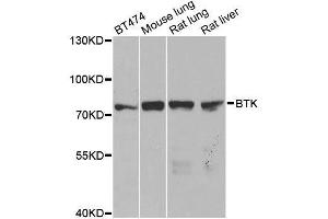 Western blot analysis of extracts of various cell lines, using BTK antibody. (BTK 抗体  (AA 173-272))