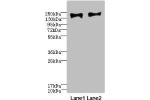Western blot All lanes: MRC2 antibody at 3. (MRC2 抗体  (AA 120-300))