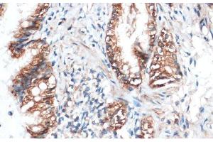 Immunohistochemistry of paraffin-embedded Rat lung using Aquaporin 4 Polyclonal Antibody at dilution of 1:100 (40x lens). (Aquaporin 4 抗体)