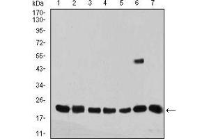 Western Blotting (WB) image for anti-Selenoprotein S (SELS) (AA 1-187) antibody (ABIN5542694)