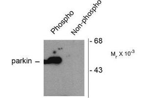Image no. 1 for anti-Parkinson Protein 2, E3 Ubiquitin Protein Ligase (Parkin) (PARK2) (pSer101) antibody (ABIN372697) (Parkin 抗体  (pSer101))
