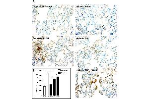 Immunohistochemistry (IHC) image for anti-Transforming Growth Factor, beta 1 (TGFB1) (N-Term) antibody (ABIN107740)