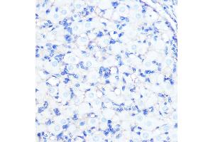 Immunohistochemistry of paraffin-embedded rat ovary using Na+/K+-ATPase Rabbit mAb (ABIN7270390) at dilution of 1:100 (40x lens). (ATP1A1 抗体)