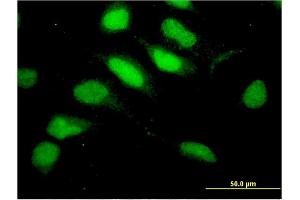 Immunofluorescence of monoclonal antibody to RNF113A on HeLa cell. (RNF113A 抗体  (AA 1-343))