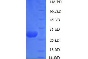 SDS-PAGE (SDS) image for Cathepsin K (CTSK) (AA 115-329) protein (His tag) (ABIN5709367)