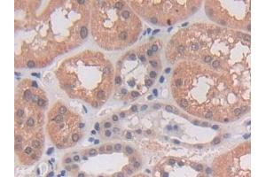 Immunohistochemistry (IHC) image for anti-Proprotein Convertase Subtilisin/kexin Type 5 (PCSK5) (AA 115-454) antibody (ABIN7435742)
