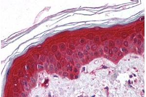 Human Skin (formalin-fixed, paraffin-embedded) stained with PYCARD antibody ABIN213971 at 5 ug/ml followed by biotinylated goat anti-rabbit IgG secondary antibody ABIN481713, alkaline phosphatase-streptavidin and chromogen. (PYCARD 抗体  (AA 182-195))