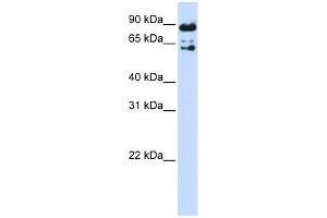 WB Suggested Anti-PPWD1 Antibody Titration: 0. (PPWD1 抗体  (Middle Region))